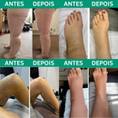 Revivo™ 3-em-1 Massageador de Pernas - Alívio para Inchaço e Má Circulação