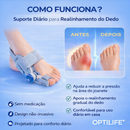 Conserto de Joanetes Optilife™