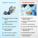 Conserto de Joanetes Optilife™