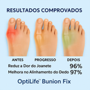 Conserto de Joanetes Optilife™